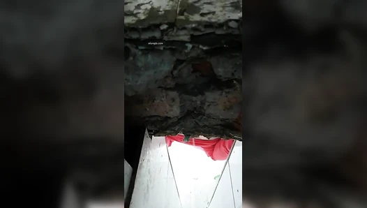 The hospital held a ditch toilet 1