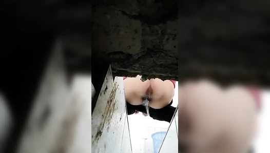 The hospital held a ditch toilet 4
