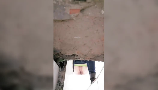 The hospital held a ditch toilet 5