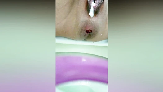 anittahotcouple - POOPING THIRTY FOUR times during TWO WEEKS!